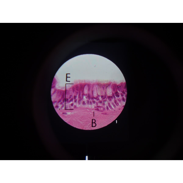 Microslide Smoking & Health